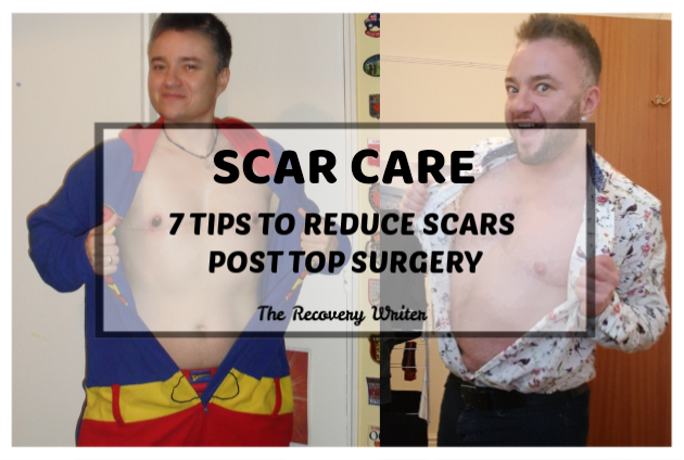 How To Reduce Scars - 7 Tips Post Top Surgery | Finlay Games